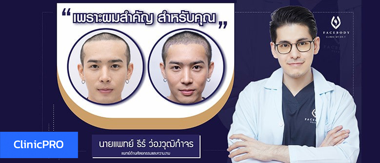 ปลูกผมที่ไหนดี